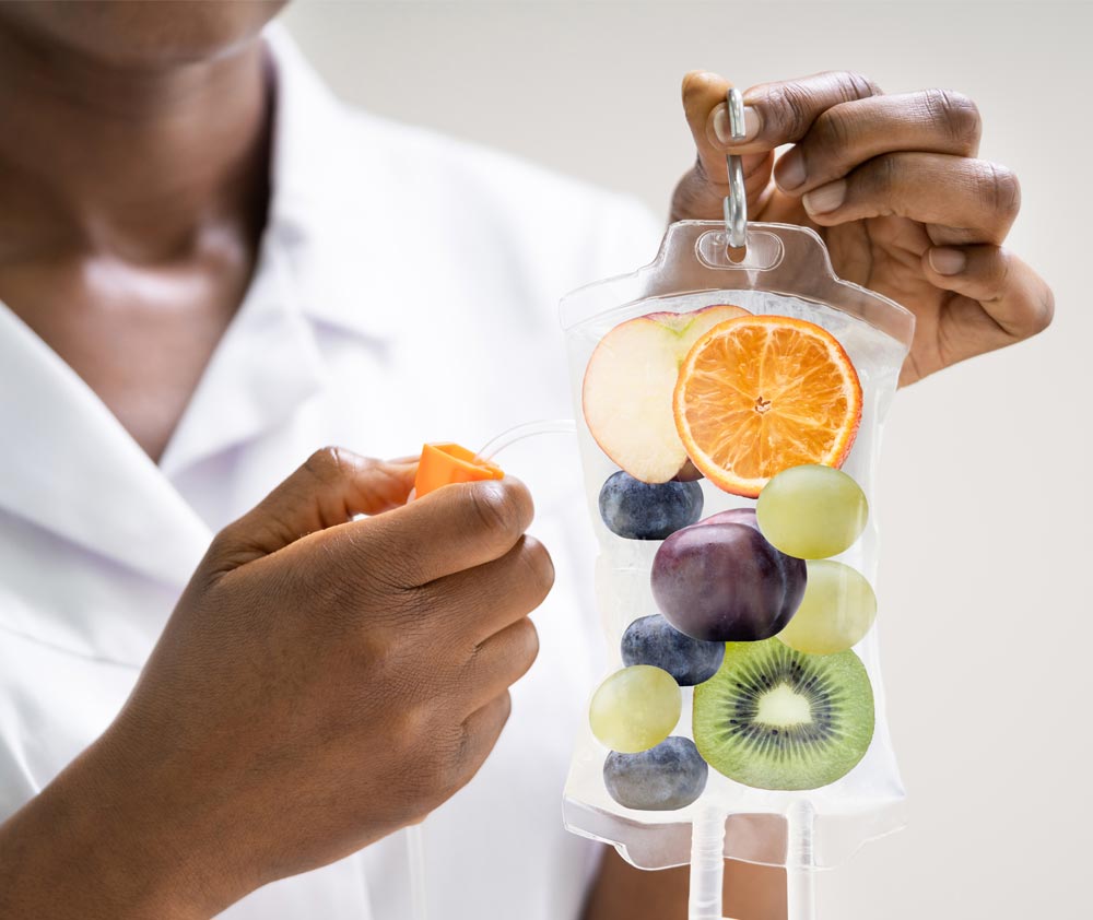 About IV's at IntergratIV